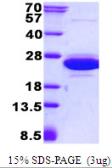 Human CNRIP1 protein, His tag. GTX68362-pro