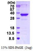 Human MMACHC protein, His tag. GTX68367-pro