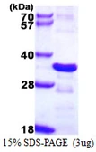 Human CHMP2B protein, His tag. GTX68368-pro
