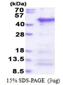 Human CCDC69 protein, His tag. GTX68371-pro