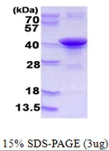 Human ARH protein, His tag. GTX68372-pro