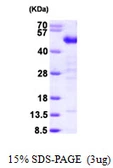 Human TES protein, His tag. GTX68373-pro