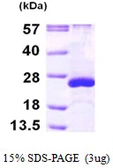 Human ARL5A protein, His tag. GTX68374-pro