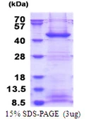 Human FBXO2 protein, His tag. GTX68376-pro