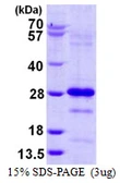 Human Pallidin protein, His tag. GTX68377-pro