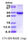 Human FBXO6 protein, His tag. GTX68378-pro