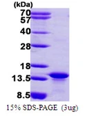 Human MYCBP protein, His tag. GTX68380-pro