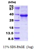 Human EHF protein, His tag. GTX68381-pro