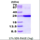 Human HSP22 protein, His tag. GTX68382-pro