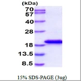 Human IL1F5 protein, His tag. GTX68383-pro