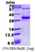 Human RGS17 protein, His tag. GTX68384-pro