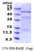 Human ELP4 protein, His tag. GTX68386-pro