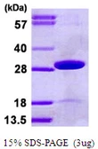 Human TPK1 protein, His tag. GTX68387-pro