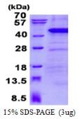 Human CARP protein, His tag. GTX68388-pro