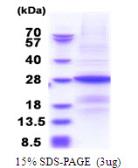 Human B9D1 protein, His tag. GTX68389-pro