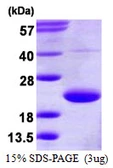 Human TRAPPC3 protein, His tag. GTX68391-pro