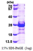 Human CacyBP protein, His tag. GTX68392-pro