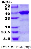 Human Syntenin 2 protein, His tag. GTX68393-pro