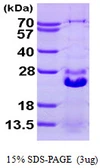Human HSPB7 protein, His tag. GTX68394-pro