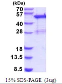 Human SNX5 protein, His tag. GTX68395-pro