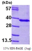 Human GNMT protein, His tag. GTX68397-pro