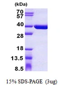 Human SULT1C4 protein, His tag. GTX68398-pro