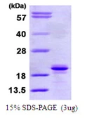 Human SIT protein, His tag. GTX68401-pro