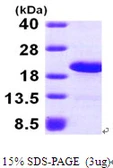 Human LSM1 protein, His tag. GTX68406-pro