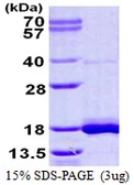 Human LSM3 protein, His tag. GTX68407-pro