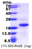 Human CRCP protein, His tag. GTX68410-pro