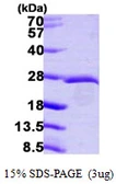 Human EIF3K protein, His tag. GTX68412-pro