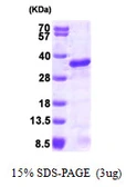 Human UBE2S protein, His tag. GTX68413-pro