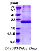 Human D15WSU75E protein, His tag. GTX68415-pro