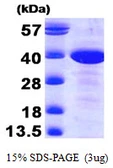Human MAT2B protein. GTX68416-pro