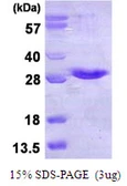 Human NKIRAS1 protein, His tag. GTX68418-pro
