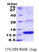 Human LAMTOR2 protein, His tag. GTX68420-pro
