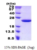 Human MCTS1 protein, His tag. GTX68422-pro