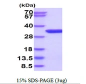 Human THYN1 protein, His tag. GTX68429-pro