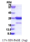 Human Amisyn protein, His tag. GTX68431-pro