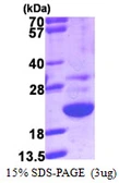 Human HSPC159 protein, His tag. GTX68432-pro