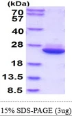 Human HSPC159 protein, His tag. GTX68433-pro