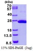 Human COMMD9 protein, His tag. GTX68435-pro