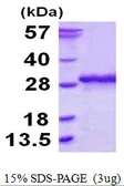 Human SSU72 protein, His tag. GTX68436-pro