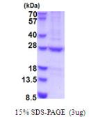 Human HEMK2 protein, His tag. GTX68437-pro