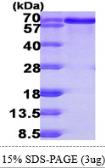 Human BLNK protein, His tag. GTX68442-pro