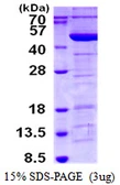 Human Tropomodulin 3 protein, His tag. GTX68443-pro