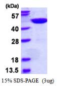 Human GTPBP9 protein, His tag. GTX68444-pro