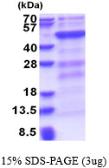 Human DNMT3L protein, His tag. GTX68448-pro