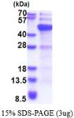 Human DNMT3L protein, His tag. GTX68449-pro