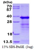 Human SERTAD1 protein, His tag. GTX68450-pro